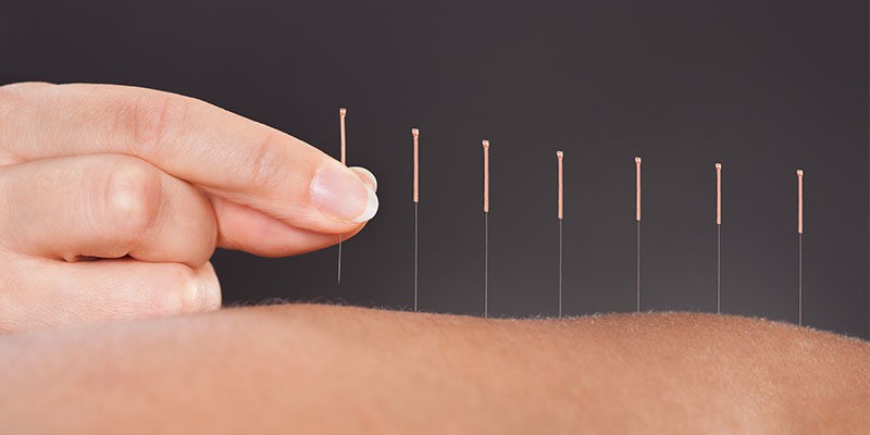 Acupuncture in Palos Heights